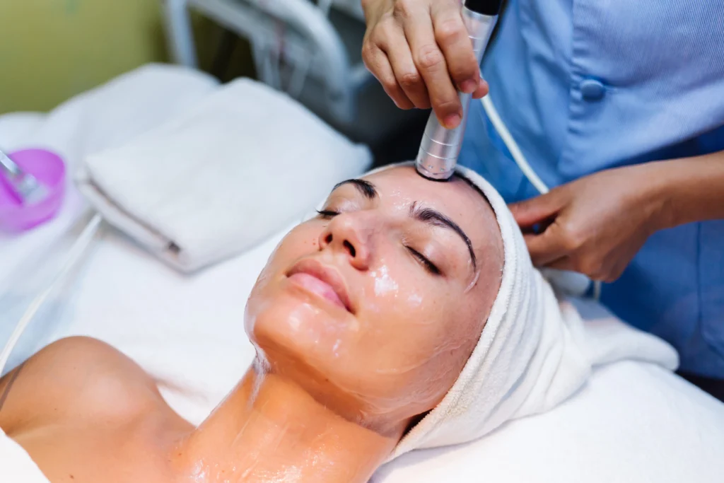 Chemical Peel Treatment